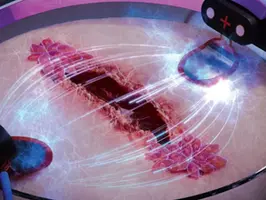 How electricity can heal wounds three times as fast