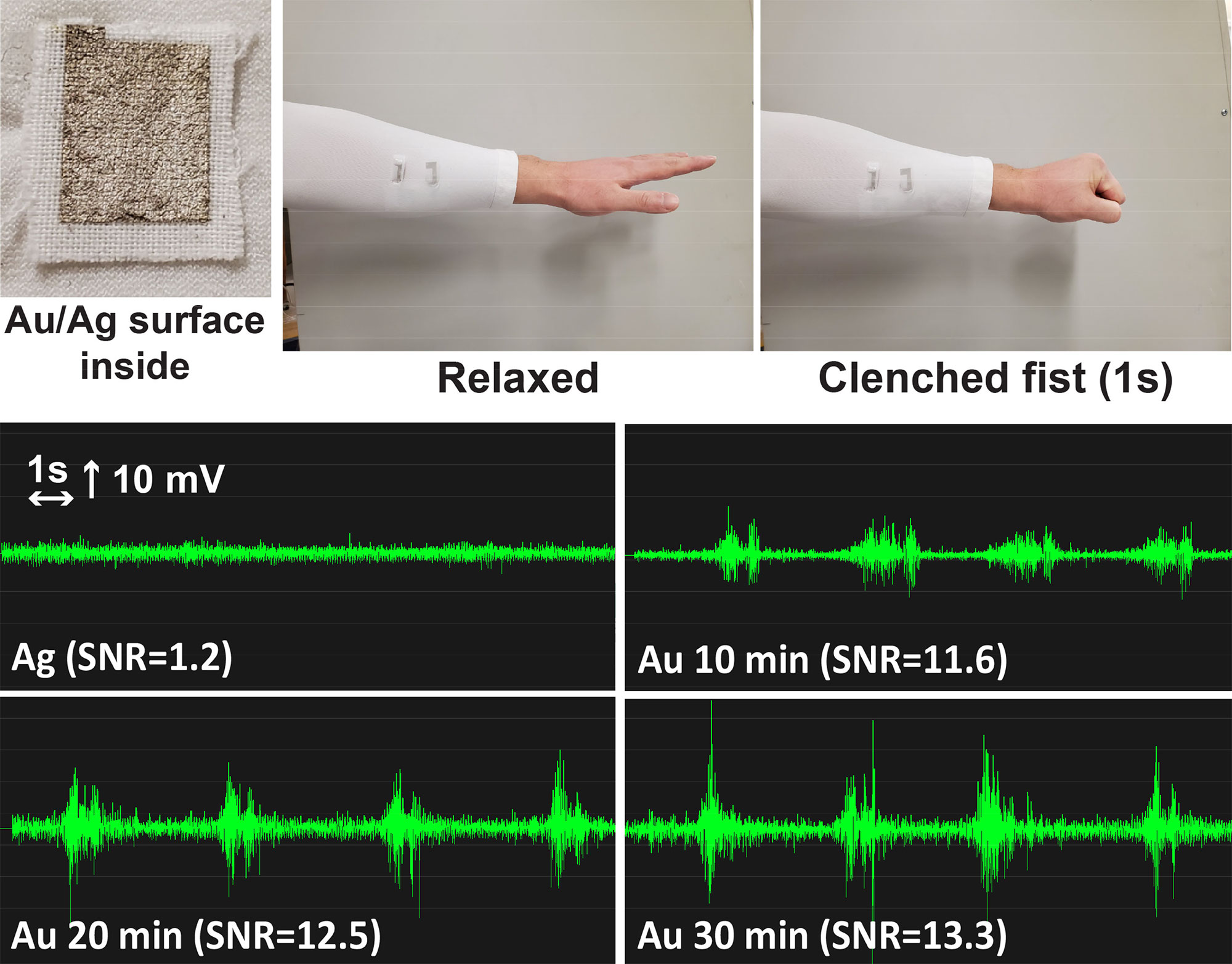 In this graphic, a compression sleeve is turned into a biosensor that measures electrical impulses generated from muscle movement. Shown is the measurement of electrical activity picked up by the sleeve when a fist is made. @ Huanan Zhang/University of Utah