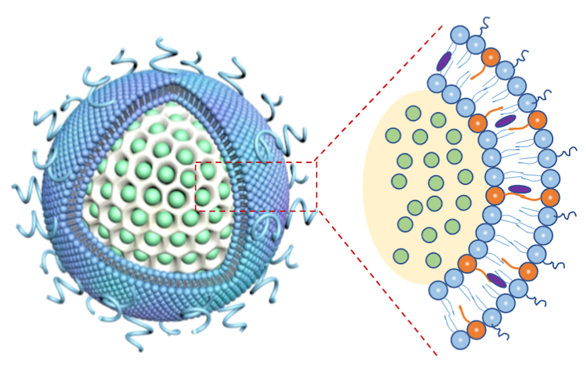 The nanocarrier's hollow glass bubble (white, at left) is packed with irinotecan (green) and is covered by lipid layers (blue) that contain the immue-boosing drug 3M-052 (orange particles in close-up image on right). @ CNSI/UCLA