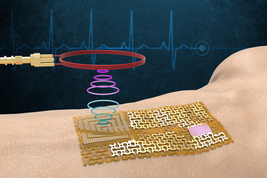 The device senses and wirelessly transmits signals without bulky chips or batteries. @ MIT