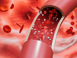 Targeted nanomedicine reduces vascular lesions, could help prevent stenosis