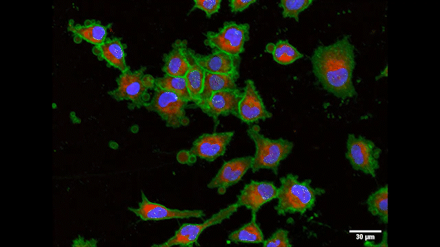 The extracellular vesicles (red) produced using the new technique are absorbed in vitro by immune cells (green; nucleus in turquoise) and can therefore influence an organism’s immune response. @ C. Alter, Department of Pharmaceutical Sciences, University of Basel