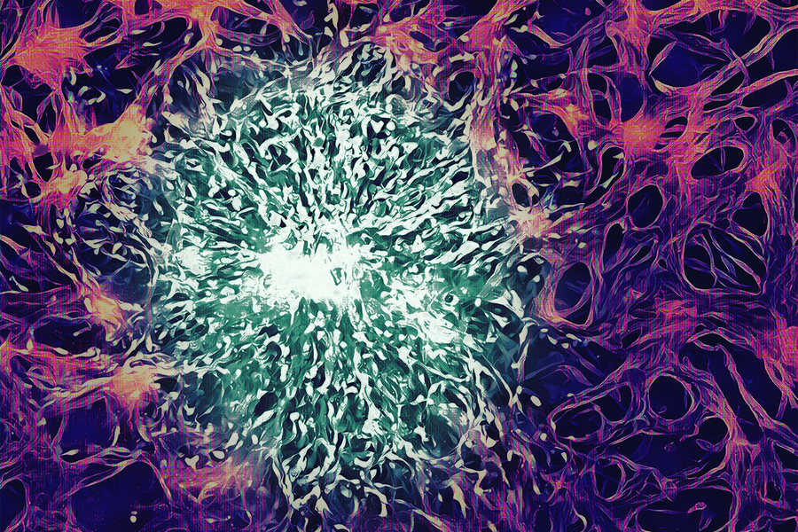 MIT researchers have created a tissue model that allows them model drug delivery to brain tumors. Tumor cells (green) are surrounded by endothelial cells (purple). @ Cynthia Hajal and Roger D. Kamm (MIT), edited by Chris Straehla