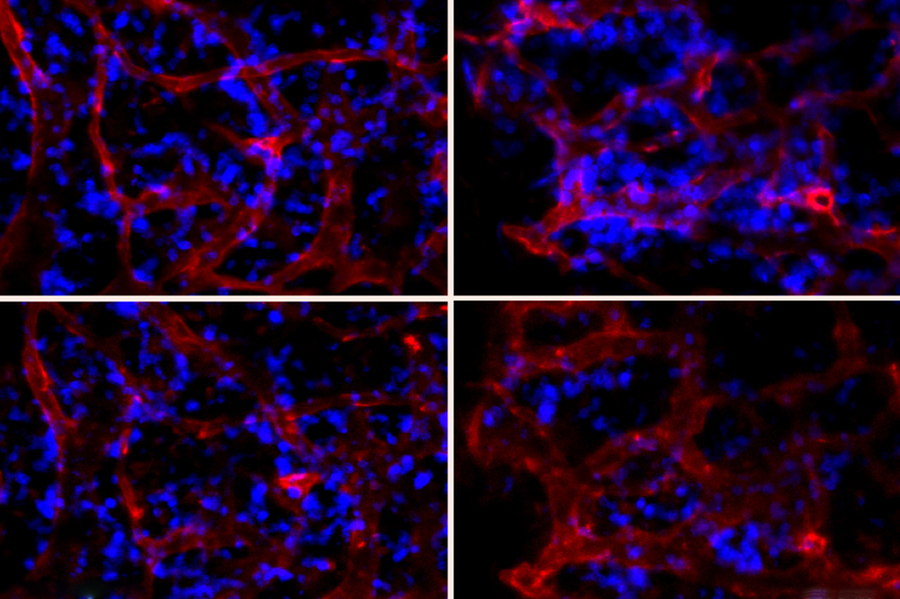 MIT researchers have shown they can deliver RNAi nanoparticles to the bone marrow, influencing their function. At top right, the bone marrow is not yet treated with particles that turn off a gene called SDF1. At bottom right, the number of neutrophils (blue) decreases, indicating that they have been released from bone marrow after treatment. At left, treatment with a control nanoparticle does not affect the number of neutrophils before and after treatment. @ Image courtesy of the researchers