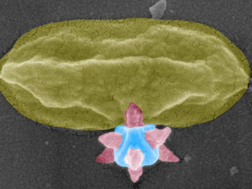 The moment of death for the bacteria. A scanning electron microscopy image of the MOF structure puncturing the bacteria. The image was taken in Myfab's cleanroom at Chalmers University of Technology, Sweden, within the study Mechano-Bactericidal Surfaces Achieved by Epitaxial Growth of Metal-Organic Frameworks. Parts of the photo have been colored.
