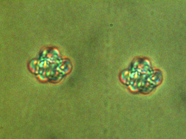 Vortex knots inside a chiral nematic liquid crystal.