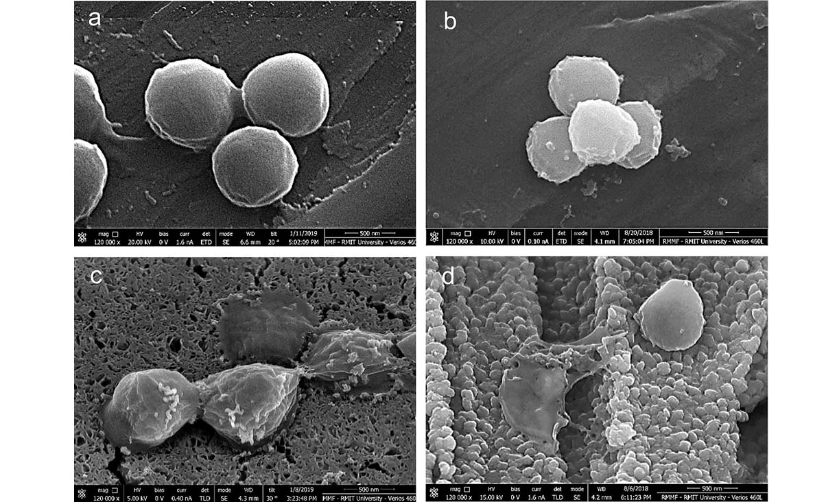 Rapid destruction: images magnified 120,000 times under a scanning electron microscope show golden staph bacteria cells after two minutes on a) polished stainless steel, b) polished copper, and in c) and d), the team’s micro-nano copper surface. @ RMIT University
