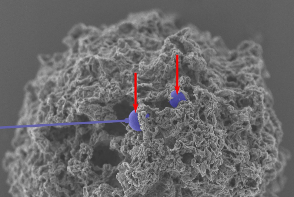 A scanning electron microscope image of nanoparticles (colorized in purple) that have successfully entered a mast cell. @ Northwestern University