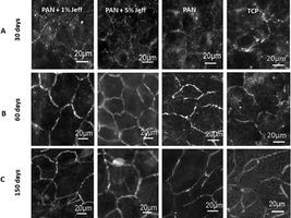 Retina cell breakthrough could help treat blindness
