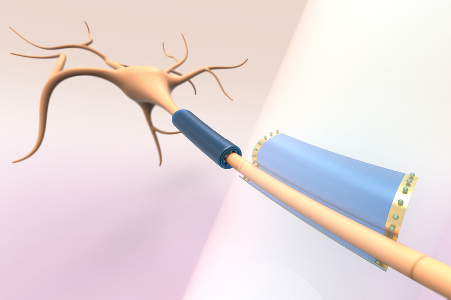 This image shows the researchers’ subcellular-sized devices, which are designed to gently wrap around different parts of neurons, such as axons and dendrites, without damaging the cells. The devices could be used to measure or modulate a neuron's electrical activity. @ Pablo Penso, Marta Airaghi