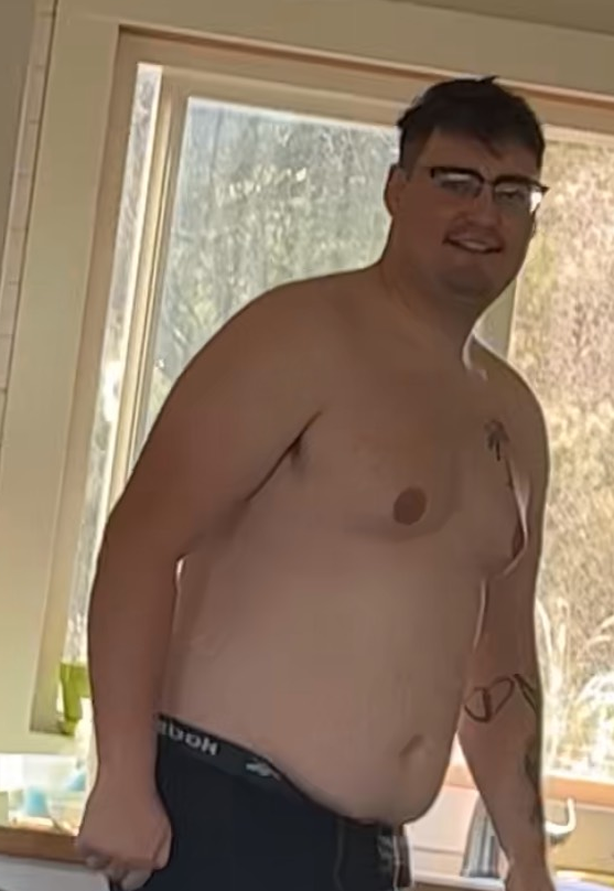 Posing without a shirt with extra weight before TRT