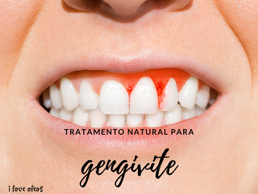 Tratamento natural para gengivite com óleos essenciais