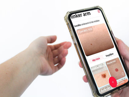 Nieuwe campagne: de Huidmonitor app