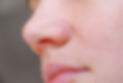 the girl has red capillaries on her nose_edited_edited.jpg