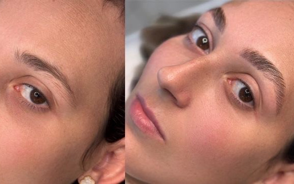 brow lamination