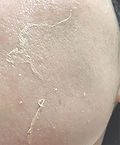 herbalpeel_case02_img01.jpg