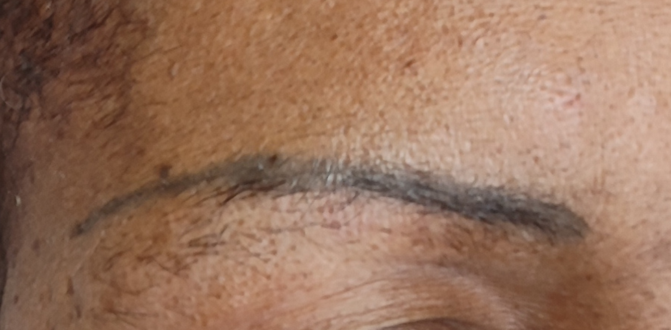 Détatouage des sourcils avant nancy