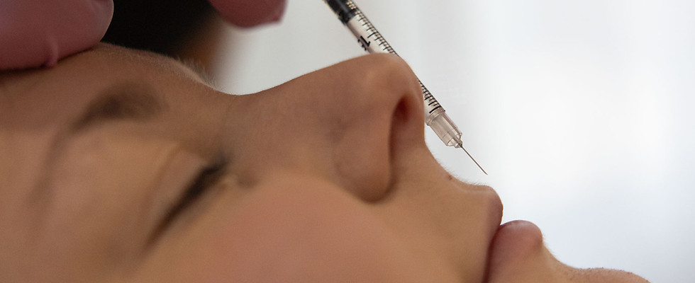 Lip filler at Pearl Aesthetics