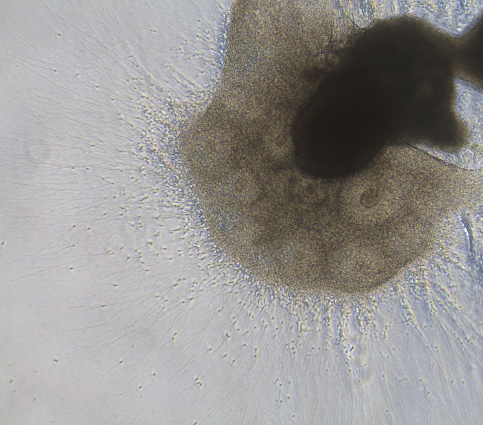 2D neural tubes (rosettes)