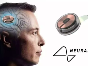 Neuralink Seeks Second Participant for Brain Chip Trials
