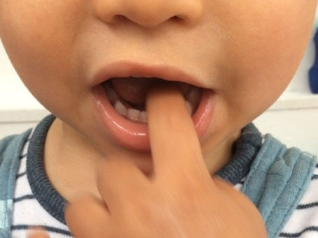 National Smile Month