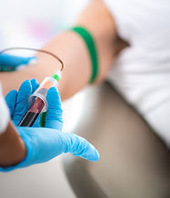 Vampire Facial & Facelift for Natural Rejuvenation - Lotus Longevity