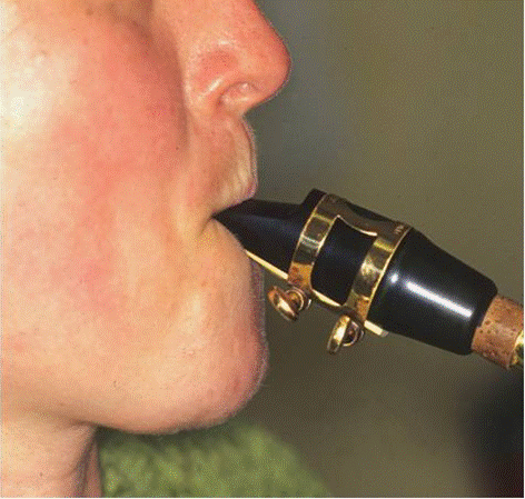 Image2.gif