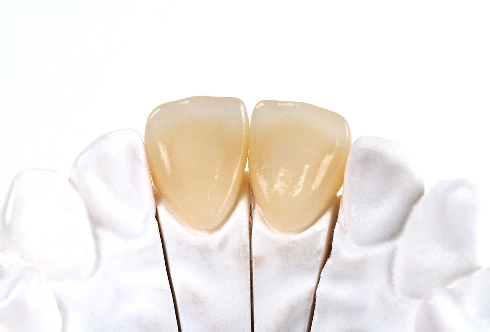 Zirconia Crown in Islamabad: Step-by-Step Dental Procedure Explained