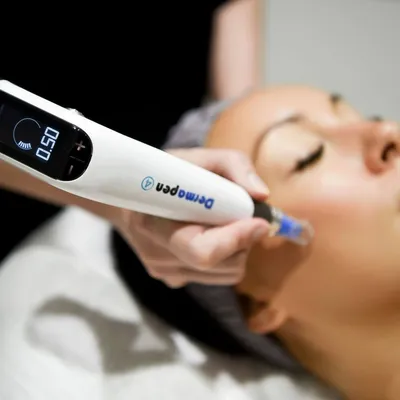 dermapen.webp