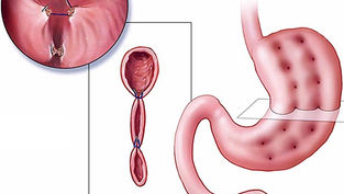 ESG represents a safe, minimally invasive and versatile intervention for obesity