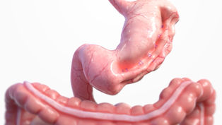 ESG associated with greater short-term weight loss than oral semaglutide