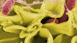 Gut microbe byproducts may help restore critical hormone-producing cells in the intestine