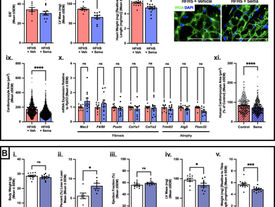 GLP-1 RAs found to shrink heart muscle in mice and human cells