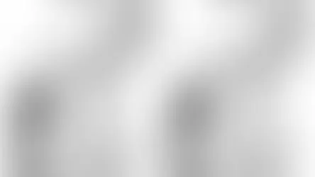 Extended pouch RYGB results in better weight loss outcomes standard RYGB