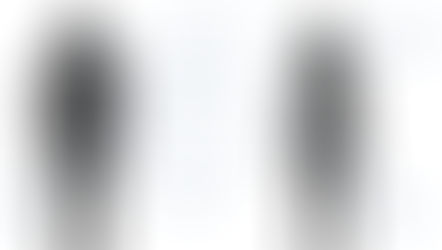 Researchers uncover mechanism explaining how obesity increases cancer risk