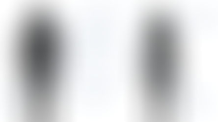 Researchers uncover mechanism explaining how obesity increases cancer risk