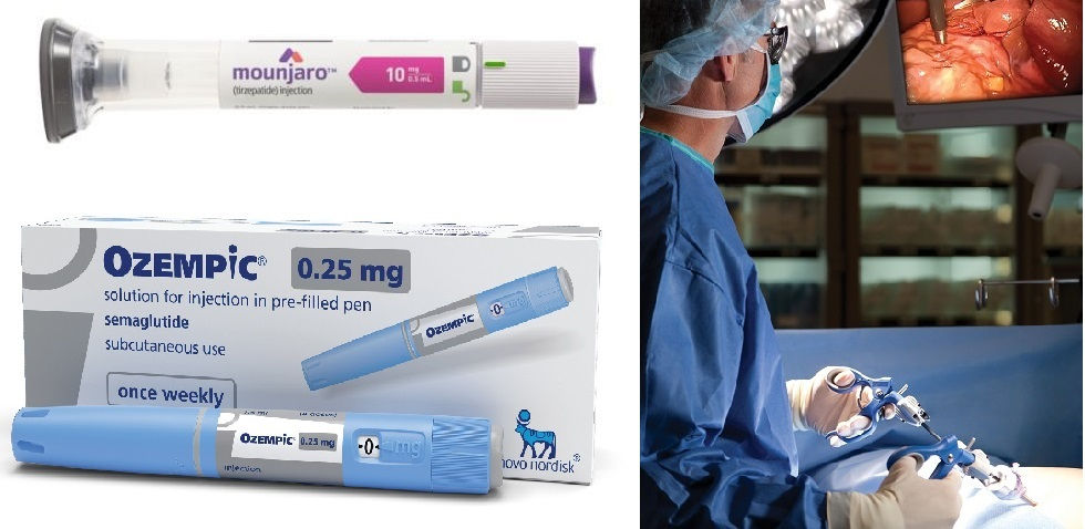 OMMs appear to be valid alternatives to EBP and MBS for mild-to-moderate obesity, but surgery more effective for patients with a higher degree of obesity