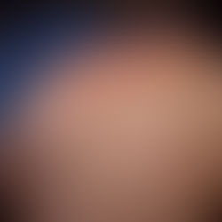 Metabolic bariatric surgery associated with an improvement in psoriasis outcomes