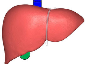MBS associated with significant reductions in the rates of adverse hepatic and extrahepatic outcomes in patients with steatotic liver disease