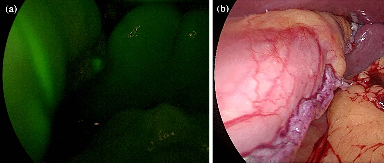 Intraoperative leak tests correlated with increase in staple line