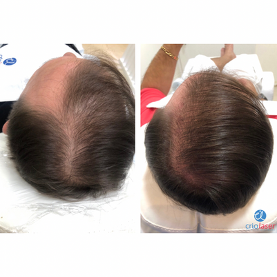 Tratamento Capilar 3.PNG