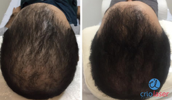 Tratamento Capilar 2.PNG