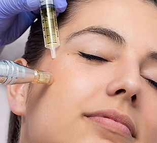 Microneedling-1.jpg