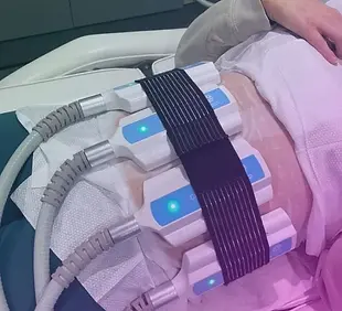Cryo-slimming-2.webp