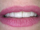 7.SORRISO-FINAL