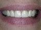 5.SORRISO-FINAL