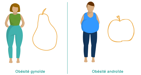 type de morphologie en minceur