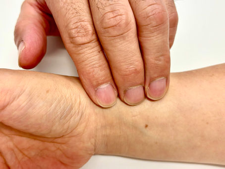 Why Acupuncture Treatment Is Not a One-Off Session