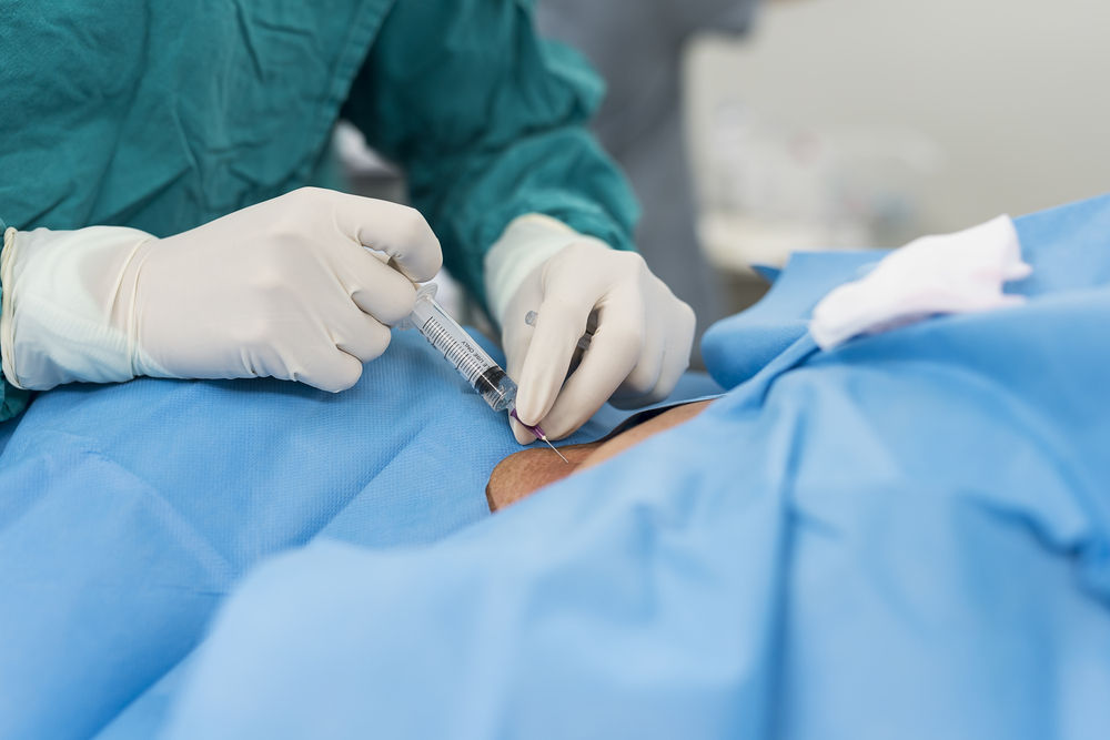 Regional Anaesthesia