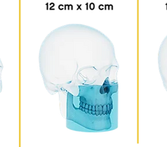 3fov-feature_edited.png